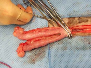 Intraoperative photograph of an open ovariohysterectomy in a dog. Antibiotics are not indicated for this clean procedure.