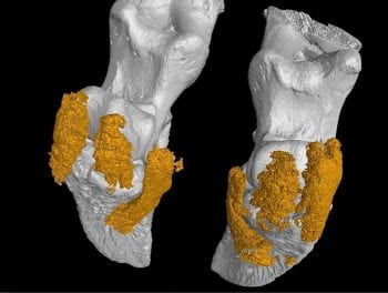 Figure 2. A 3D CT image showing three distinct pillows of fat, part of the digital cushion, which extend beneath the pedal bone. They are a bit like the air-cushioned soles in sports trainers.