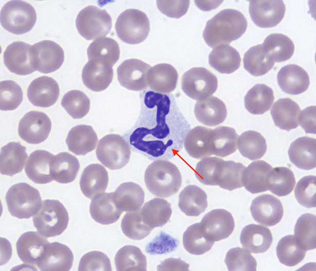 Figure 2. Blood smear image.