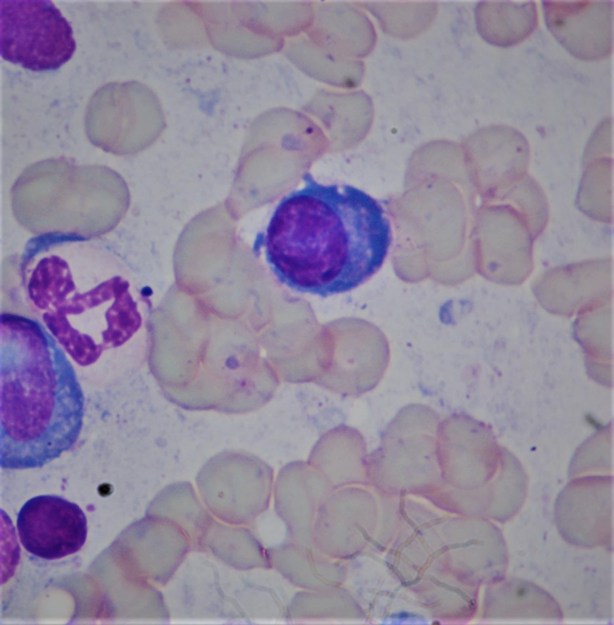 Plasma-cell_purple