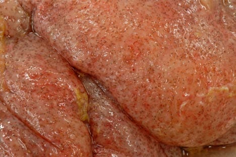 Figure 3. Marked colonic oedema associated with a large burden of cyathostomin larvae