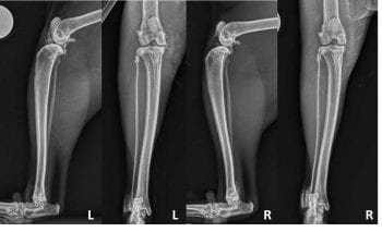 Figure 1. Mediolateral and caudocranial views of the left and right stifles. Radiographs of the left stifle reveal opacification encroachment of the infrapatellar fat pad and caudal bulging of the subgastrocnemial fascial plane consistent with synovial effusion. Several large intra-articular mineralised bodies are apparent, concentrated cranially and medially in addition to mild-to-moderate periarticular osteophytosis predominantly affecting the tibia. Radiographs of the right stifle reveal a small intra-articular mineralised body situated cranio-medially, but no evidence of effusion or secondary osteophytosis.