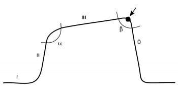 Phases and angles of a capnogram. The arrow indicates fractional expired CO2.