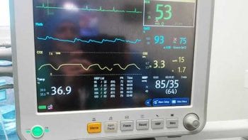 CO2 rebreathing due to malfunction of a unidirectional valve in a circle system.