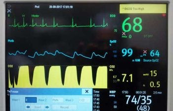 Moderate hypercapnia.