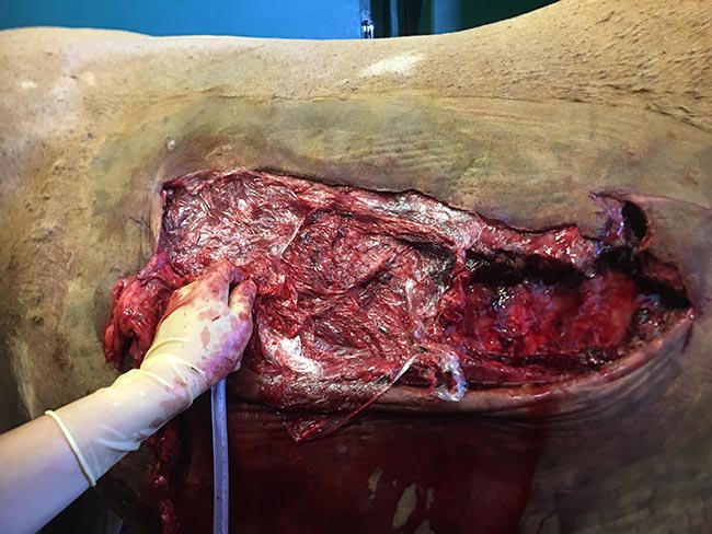 Figure 2. Cling film is helpful to prevent air from entering the thorax while the patient is assessed and prepared for surgery. Owners can be asked to apply cling film prior to the vet’s arrival for patients with severe trauma to the thorax. In this case of severe thoracic trauma and bilateral pneumothorax, a suction tube is being held in place under the cling film to remove air from the pleural space.