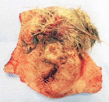 Figure 8. Screw tail following amputation to be sent for histopathology. Image: AHT.