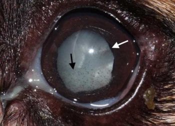 Figure 8. Lens-induced uveitis. Note the congested episcleral vessels, the hyperpigmented iris and the mature cataracts with waterclefts.