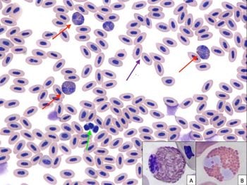 Figure 1. Blood smear. Inset: (a) heterophil; (b) eosinophil.