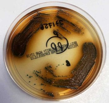 Figure 2 (top). A Brilliance urinary tract infection agar plate with a mixed growth of two types of colonies: clear brown and dark turquoise. A single colony of each will need to be looped from the plate and inoculated on to fresh agar plates for further incubation prior to identification.