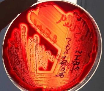 Figure 3. A blood agar plate with Streptococcus canis showing beta (complete) haemolysis of the red cells in the media leading to yellow, clear area around the colonies. This contrasts with alpha haemolysis where the agar under the colony will appear dark greenish (shown by some enterococci, as well as the human pathogen Streptococcus pneumoniae). No haemolysis, referred to as gamma haemolysis, is shown by some enterococci.