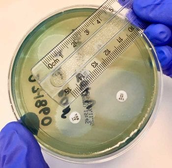 Figure 6. Agar disc diffusion susceptibility testing showing zones of inhibition of bacterial growth around antibiotic discs.