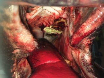 An alveolus post-extraction packed with dental putty.