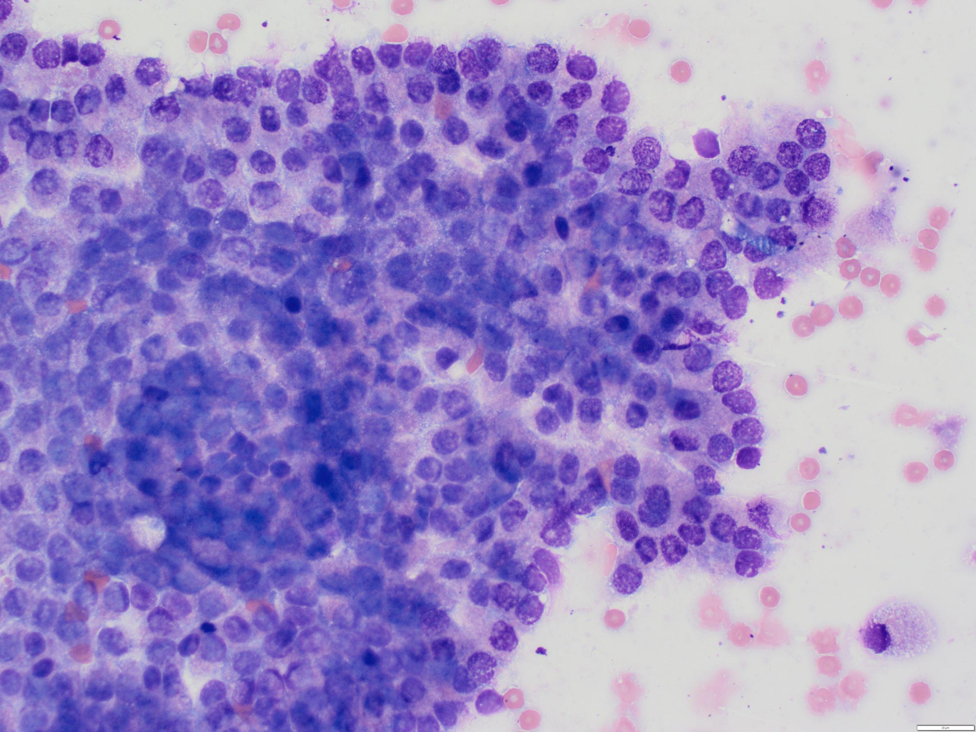 Normal prostate epithelium (500× magnification) showing “honeycomb” pattern.