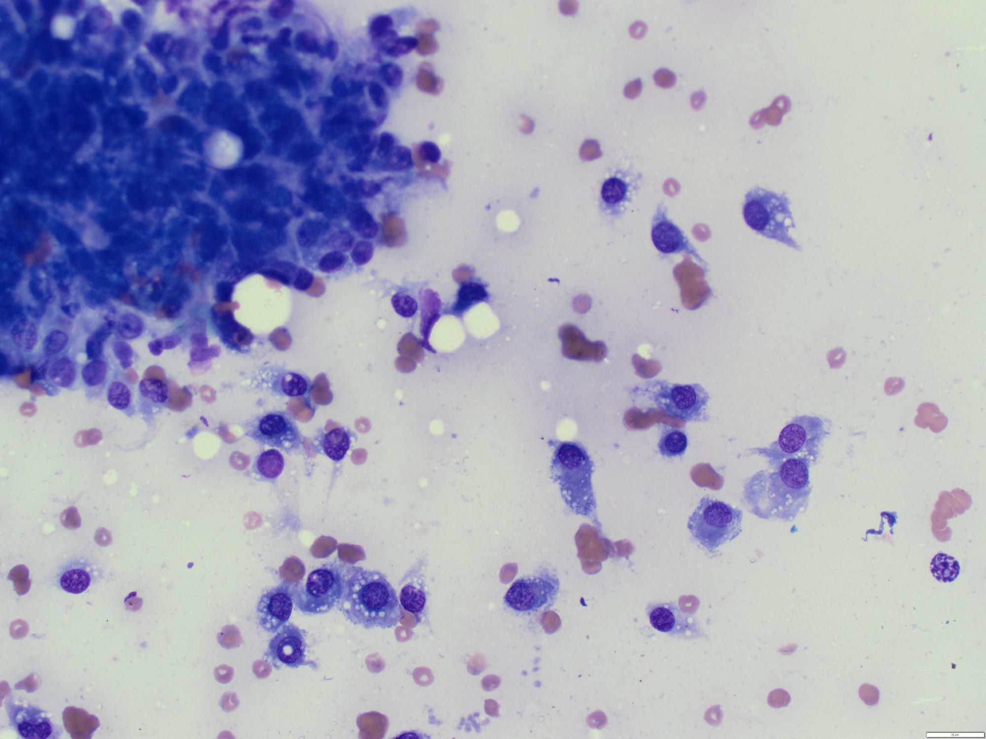 mesenchymal cells