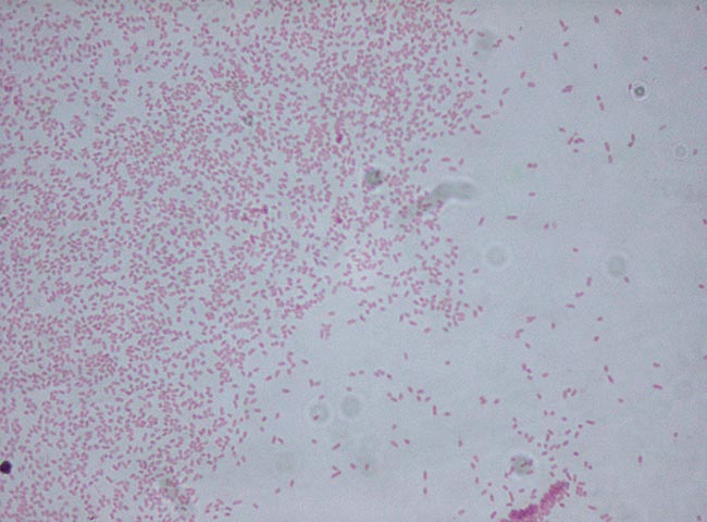 A Gram stain of <em>Pantoea agglomerans</em> under 1,000× magnification. <a href="https://commons.wikimedia.org/w/index.php?curid=29339191" target="_blank">Image</a> © Dr. Sahay - Own work, <a href="https://creativecommons.org/licenses/by-sa/3.0/deed.en" target="_blank">CC BY-SA 3.0</a>.