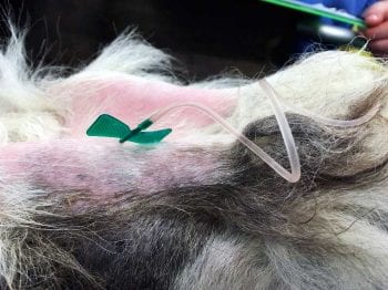 Figure 3. A butterfly type cannula placed in a peripheral artery for direct measurement of arterial blood pressure.