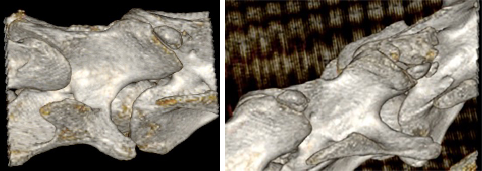 Reconstructed images of a horse’s neck, showing several fragments within the facet joints.