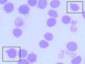 What are the abnormal cells on this blood smear? In-house cytology will be discussed at the ISFM UK Feline Congress.