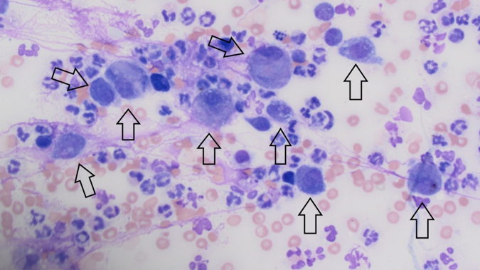 leukocyte_3