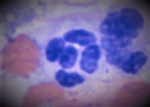neutrophil01