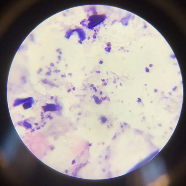 Malassezia on ear cytology.