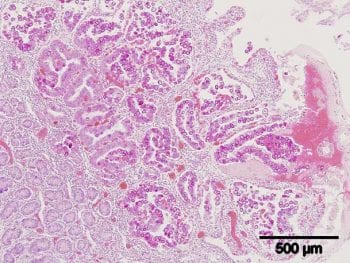 Figure 4. Coccidial replication in the intestinal villi.