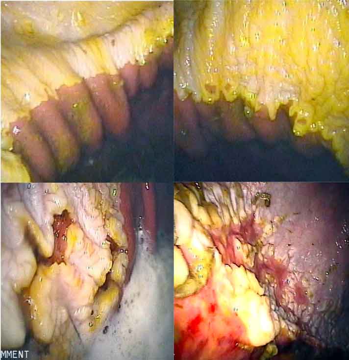 Figure 2. Examples of equine squamous gastric disease.