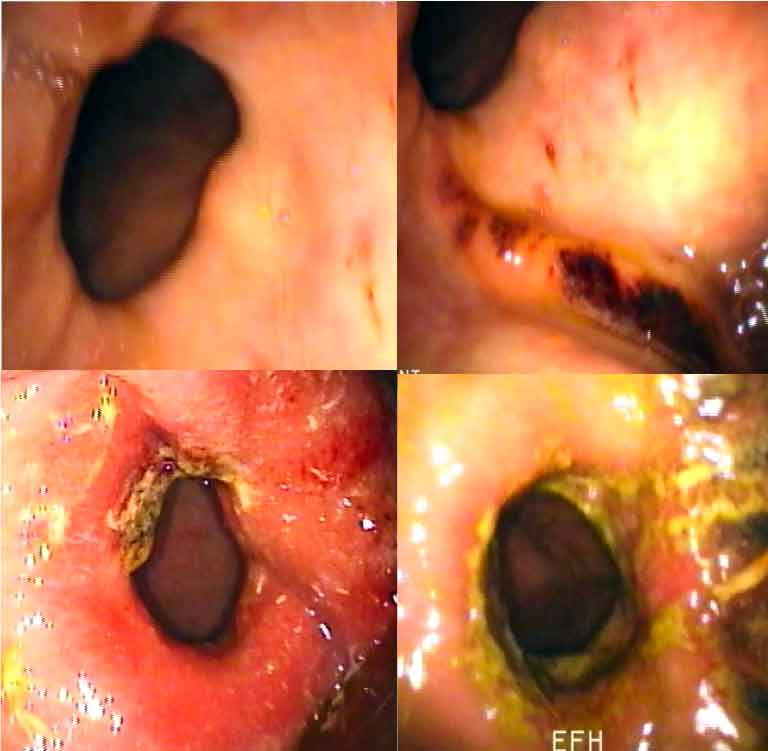 Figure 3. Examples of equine glandular gastric disease.
