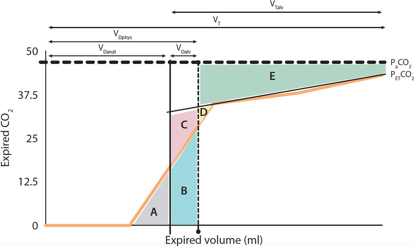 Figure 6. Diagram representing a volumetric capnography during a normal respiratory cycle. PaCO2 = the arterial tension of CO2; PECO2 = the concentration of mixed expired CO2; PETCO2 = the end-tidal partial pressure of CO2; VDanat = the volume of anatomical VD; VDalv = the volume of alveolar VD; VDphys = the volume of physiological VD; VT = tidal volume; VTalv = the alveolar VT. A, B, C, D and E are different areas.