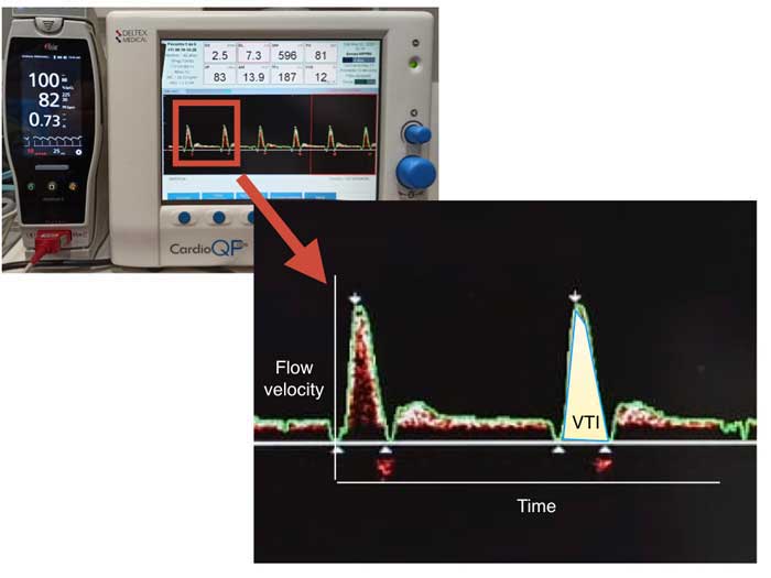 Figure 3. Transoesophageal Doppler monitoring during maintenance of anaesthesia in a dog.