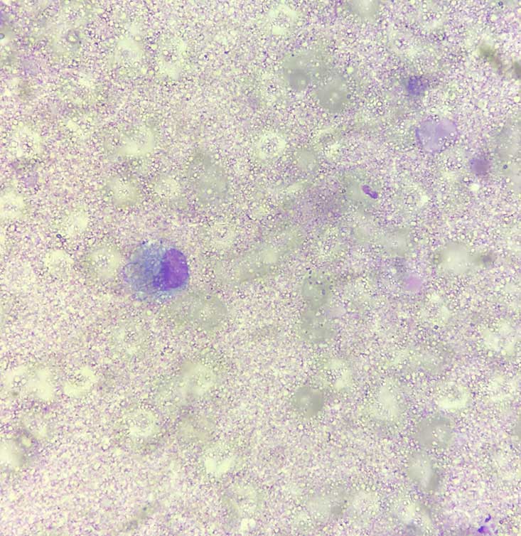 Photomicrograph at 50× magnification.