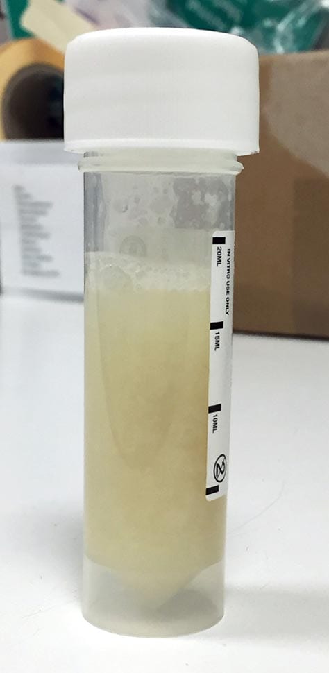 Figure 1. A tracheal wash sample from a horse with severe equine asthma.