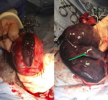 Figure 4. Intraoperative photographs showing (left) incision into the vaginal tunic to reveal (right) a grossly discoloured and enlarged right testicle. The green arrow indicates a dilated epididymis, which was observed on the ultrasound scan.