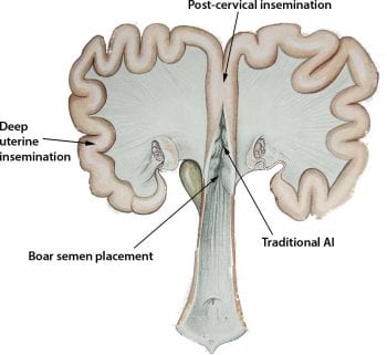 Figure 2. Placement of the catheter for post‑cervical insemination.