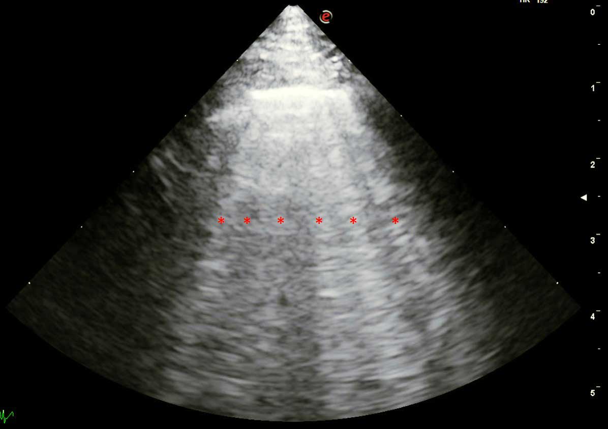 Figure 3a. Point-of-care ultrasound image. 3a. Multiple B-lines (red stars) in a dog with cardiogenic pulmonary oedema.