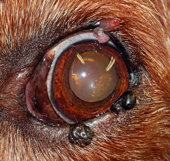 Figure 11. Melanocytomas affecting the left lower eyelid. A meibomian gland adenoma was present within the upper eyelid.