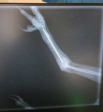 X-ray showing August's broken leg.