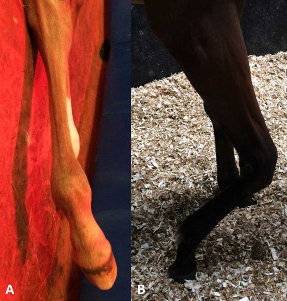 Figure 2. A. Marked angular limb deformities in a foal showing fetlock valgus. B. Marked carpal contracture in a yearling.