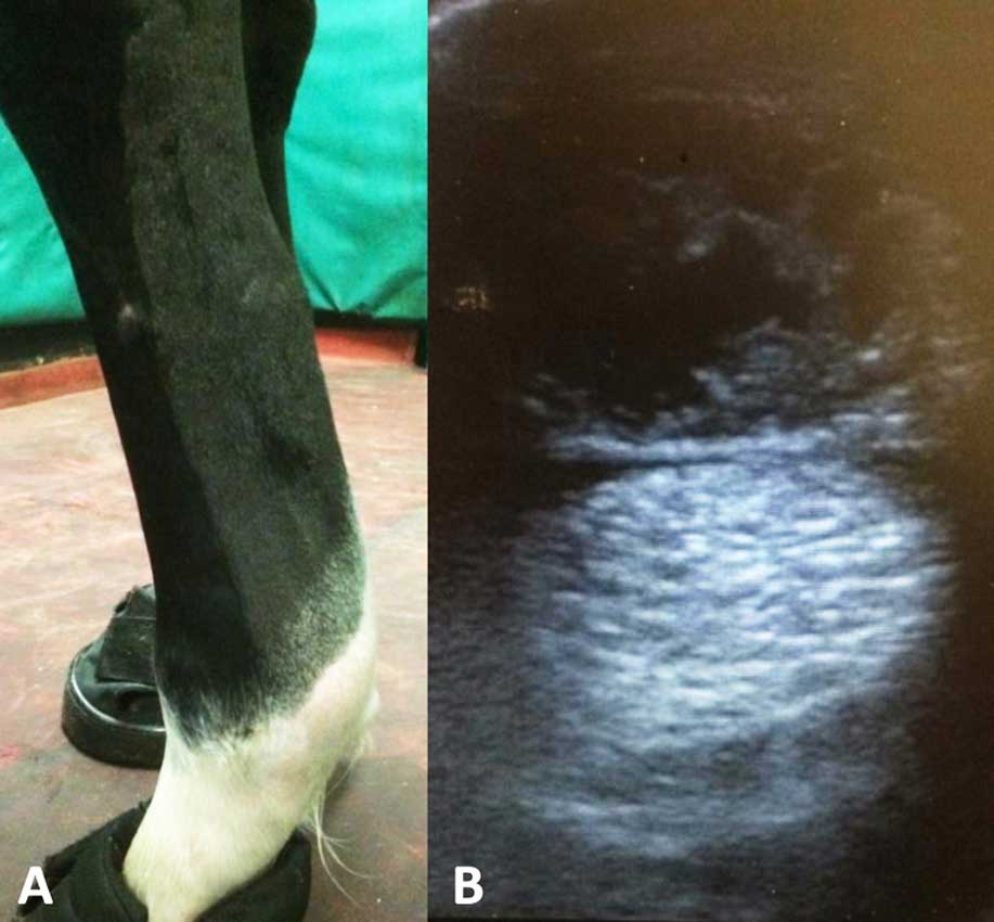 Figure 4. A. Soft tissue swelling on palmar aspect of superficial digital flexor tendon (SDFT). B. Ultrasound image of the same leg showing loss of fibre pattern and a large hypoechoic areas within the SDFT. This was a septic SDF tendonitis following platelet-rich plasma administration.