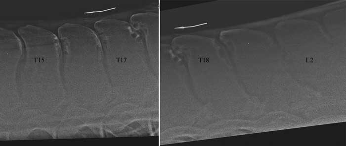 Figure 2. Radiographs of the caudal thoracic and lumbar regions of an eight-year-old Thoroughbred-cross used for polocrosse. The horse exhibited rodeo-type bucking when ridden. Closeness or impingement of the spinous processes is from the 14th thoracic to 3rd lumbar vertebrae. Bucking was abolished when local anaesthetic solution was injected around these spinous processes.