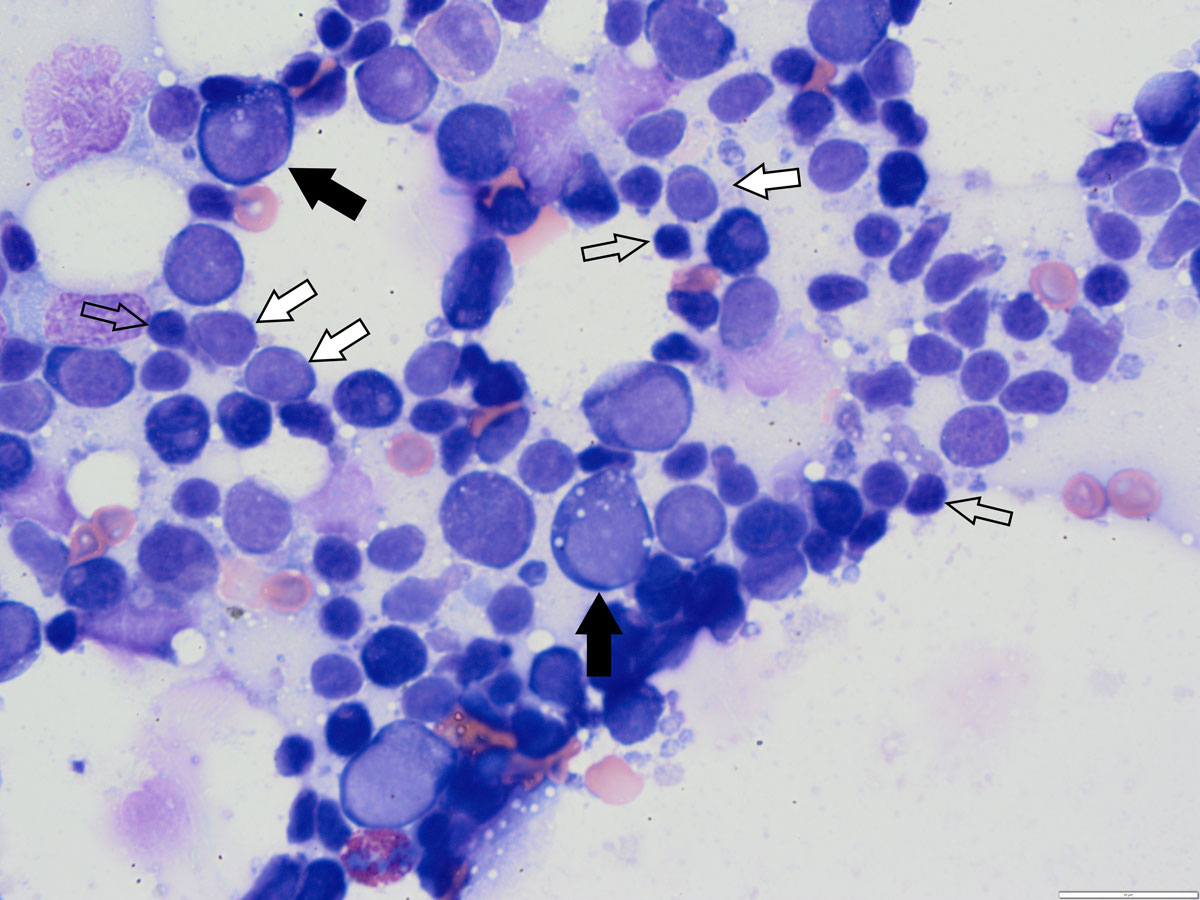 lymphocytes