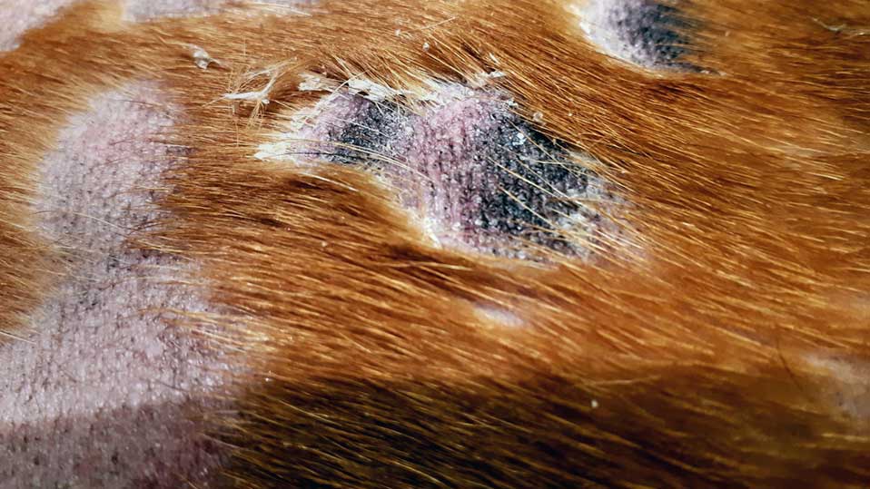 Figure 2b. Epidermal collarettes are secondary lesions that have arisen following the rupture of pustules. They are characterised by a ring of scale with often crusting or post‑inflammatory hyperpigmentation in the centre.