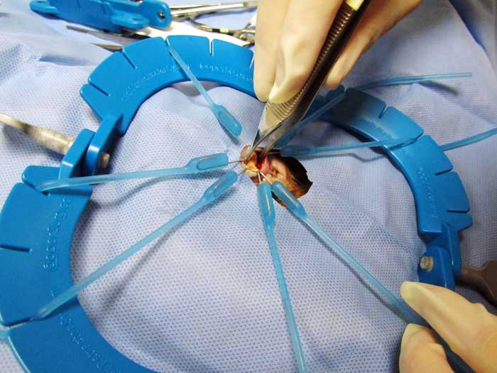 Figure 12. An urethrotomy may be performed to retrieve urethral uroliths.