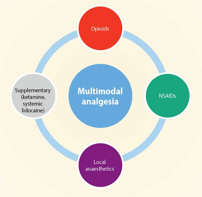 Figure 1. Multimodal analgesia.