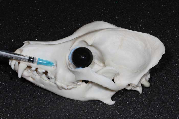 Figure 2. A demonstration of how an infraorbital nerve block is carried out.