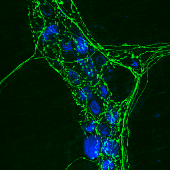 Immunocytochemistry