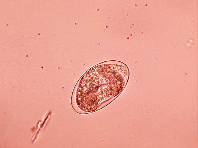 Figure 3. Larvated hookworm ova.