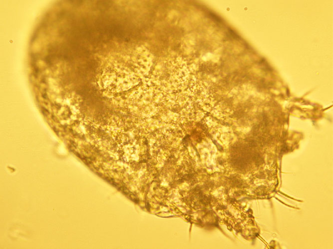 Figure 2. A hatching grain mite egg.