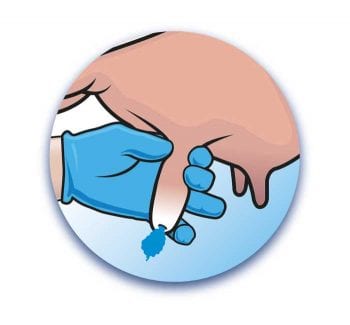 Ubroseal-ejecting-Teat